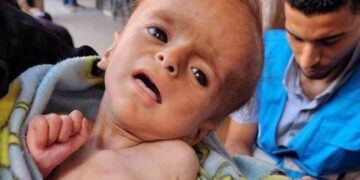 Israeli Minister Backs Starvation Policy in Gaza