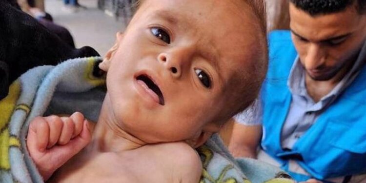 Israeli Minister Backs Starvation Policy in Gaza