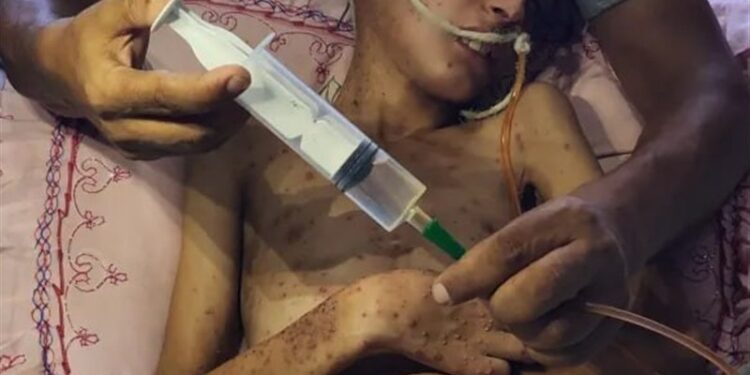 Over 60,000 Palestinians Killed As Israel Intensifies Brutal Onslaught on Gaza